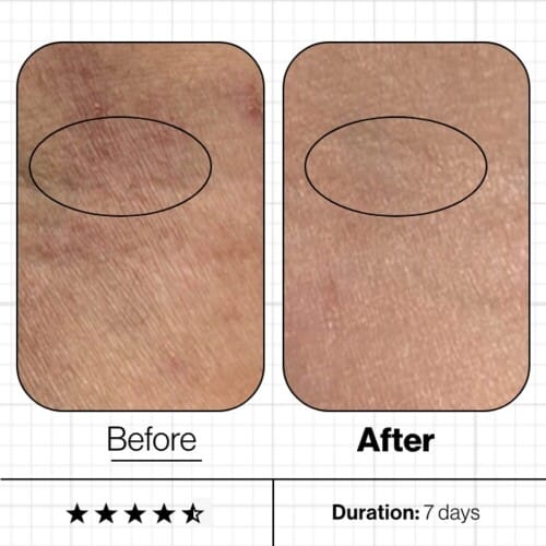 ANP Skin Moisture IQ (3)