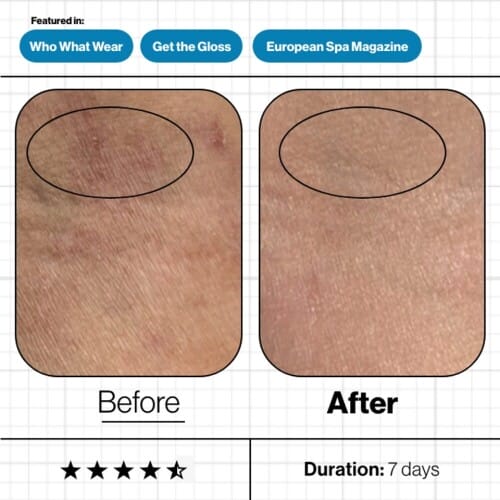 ANP Skin Moisture IQ (4)