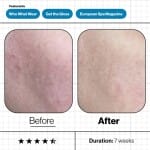 ANP Skin Moisture IQ (5)