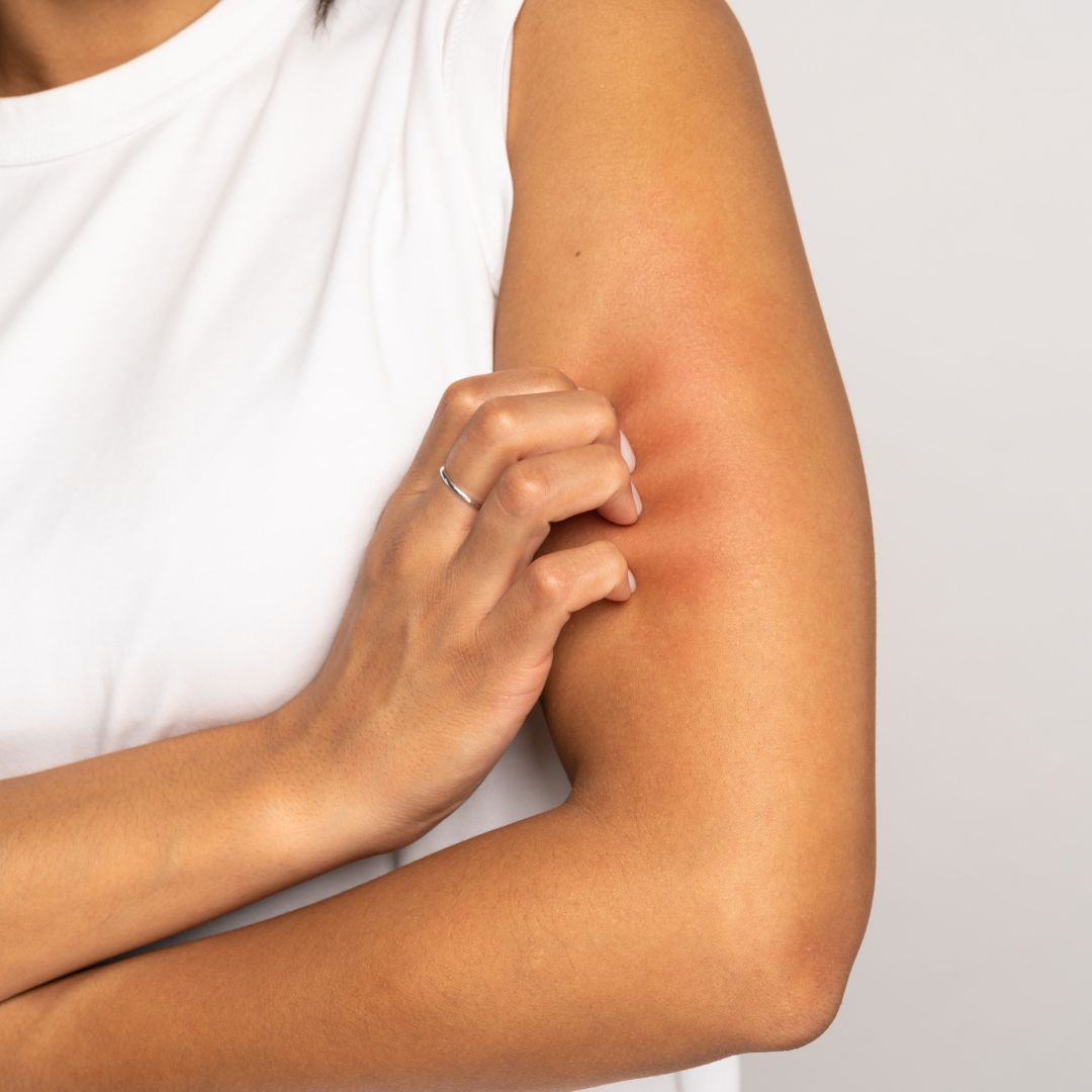 Taking Care of Dry Skin Top 10 Tips