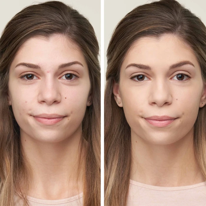 disappear full coverage concealer dark Before & After