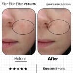 ANP Skin Blue Filter (3)
