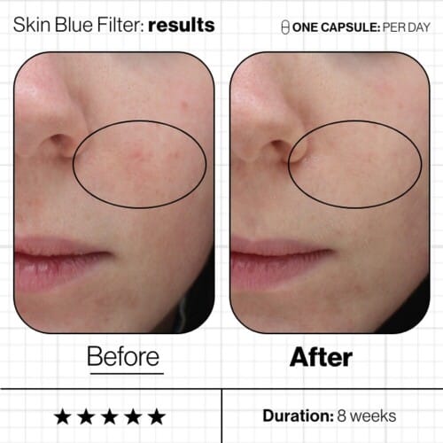 ANP Skin Blue Filter (3)