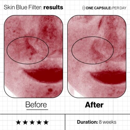 ANP Skin Blue Filter (4)